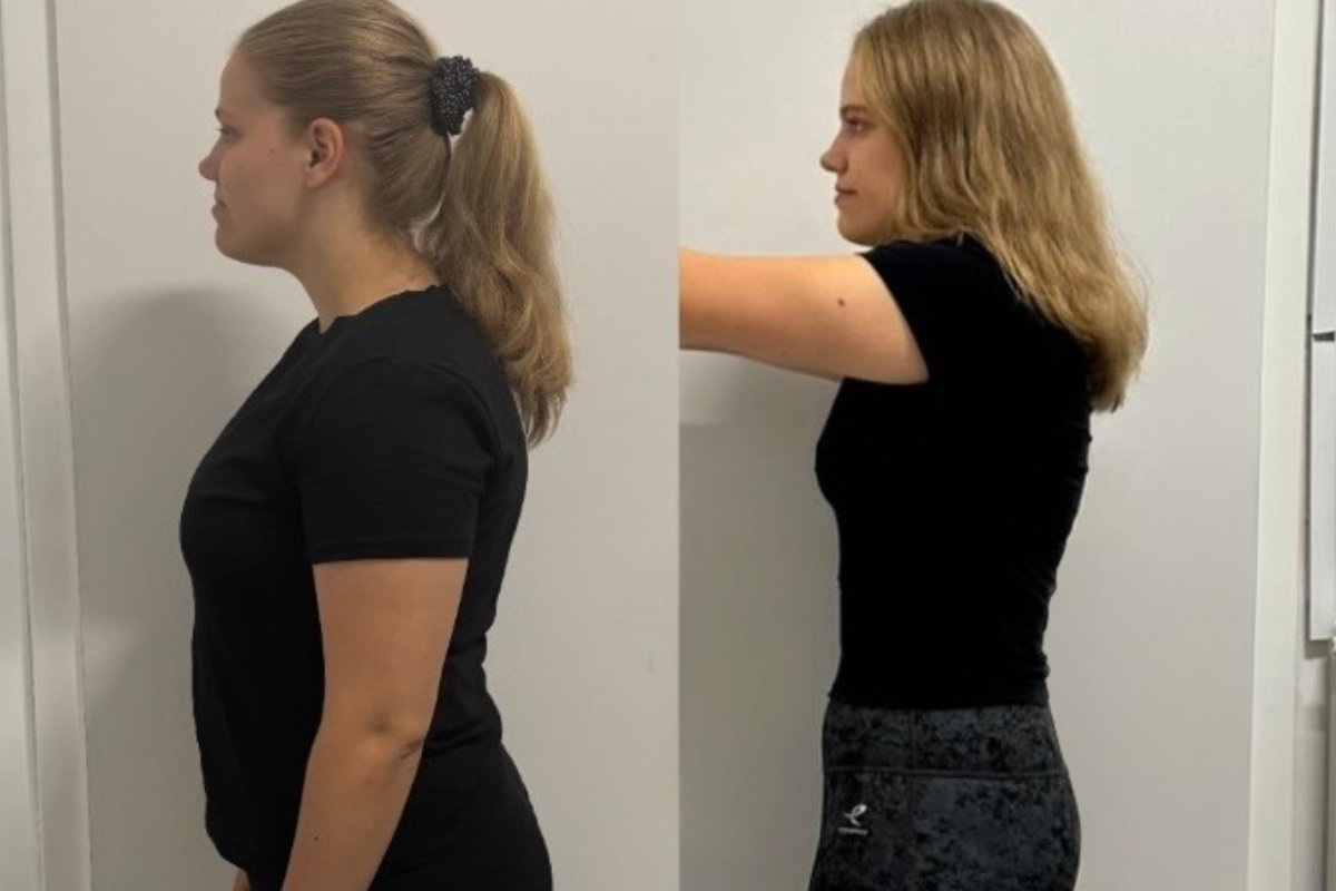 Preobrazba: hujšanje